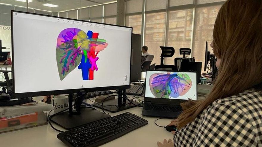 La ‘startup’ murciana que ayuda a los cirujanos a operar con modelos en 3D de órganos de pacientes