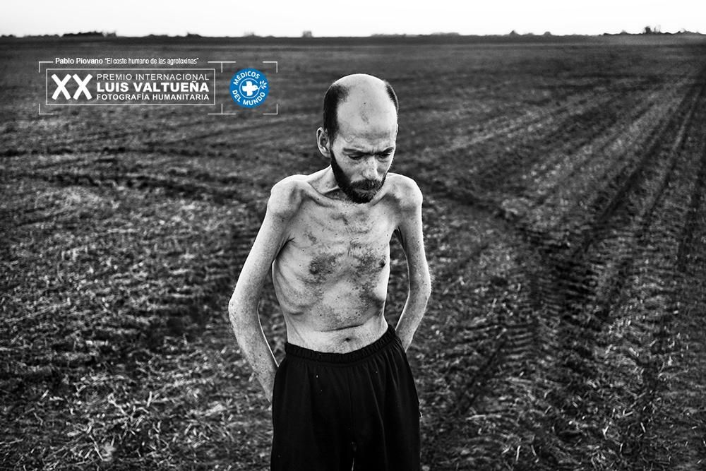 29-10-2016. Entre Ríos, Argentina. Durante años Fabián Tomasi trabajó durante años para una compañía de fumigación aérea, cargando y bombeando productos químicos. Sufre una neuropatía tóxica severa y actualmente está en tratamiento por atrofia muscular general, lo que le obliga a guardar cama. Fabián se ha convertido en un ejemplo viviente del impacto de los agrotóxicos en la salud humana. Dedica su vida a la sensibilización sobre este problema.