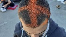 Fotografías difundidas por la organización DRC en las que se muestran cómo varios migrantes tienen cruces pintadas con spray en la cabeza