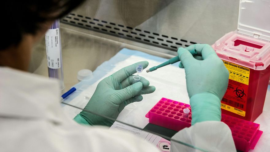 Documentan un caso especial de remisión del VIH tras un trasplante de células madre a un enfermo de cáncer