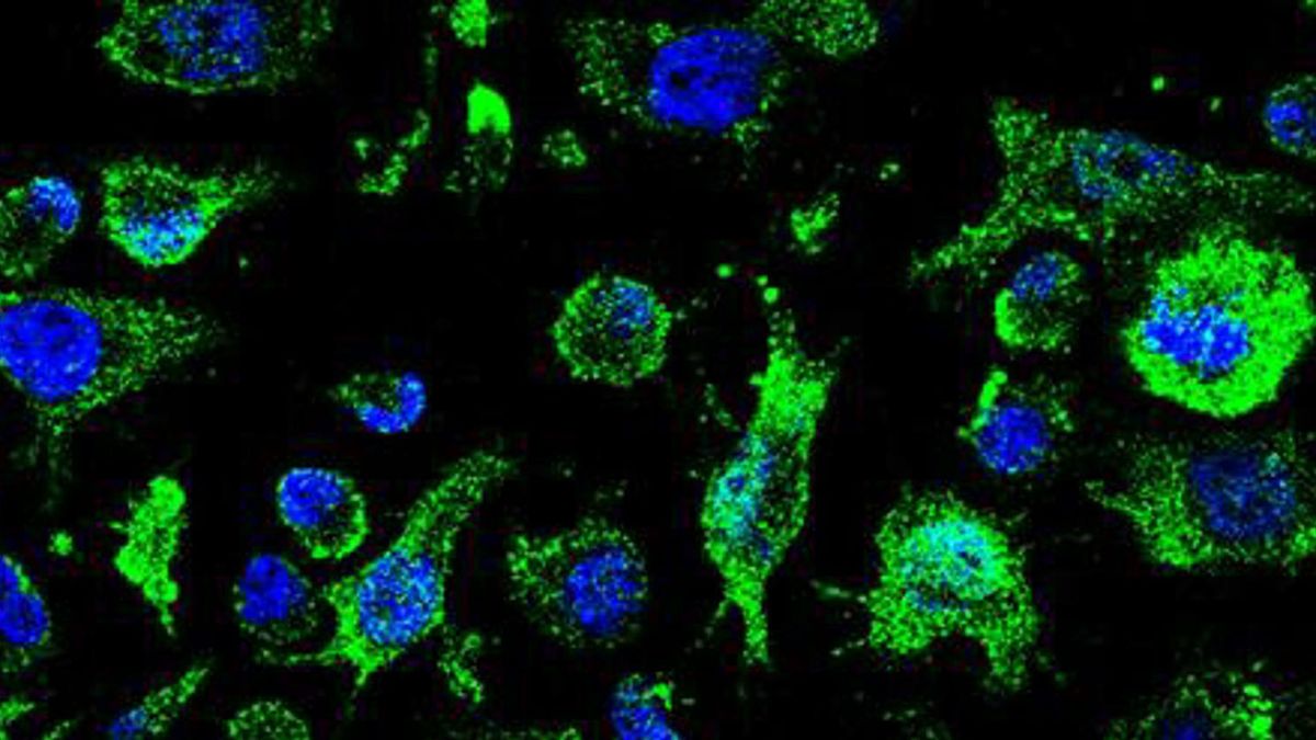 España inicia los ensayos clínicos de un fármaco contra la ELA