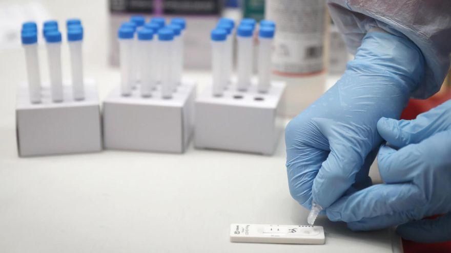 La Palma registra 193 nuevos positivos por COVID y 282 altas