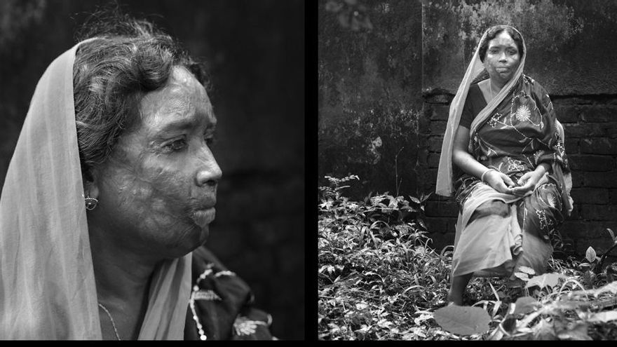 FOTOGALERÍA: Día contra la violencia de género; huellas irreversibles