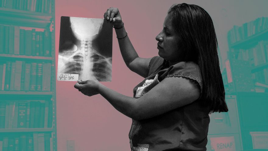 Trabajadora mostrando una radiografía de su columna vertebral