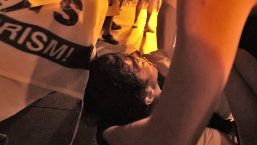 Un fotoperiodista acaba con la cabeza ensangrentada por el porrazo de un agente en la protesta contra la turistificación en Palma