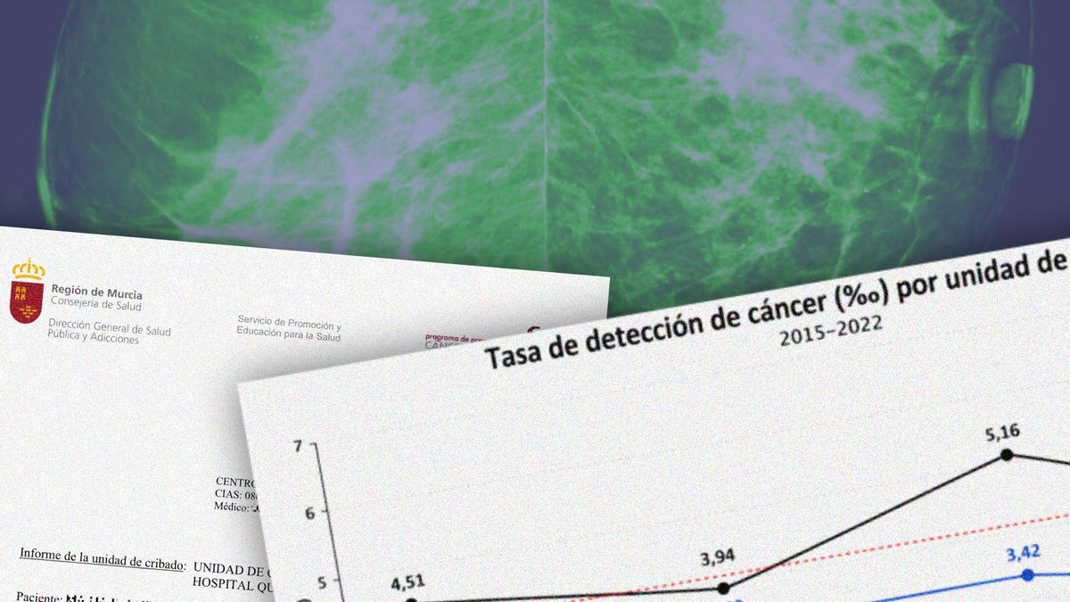 Retrasos "evitables" en un 10% de los diagnósticos de cáncer de mama en Murcia: "Tras medio año dijeron que tenía micrometástasis"
