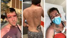 El joven agredido en el Hospital General de Castelló