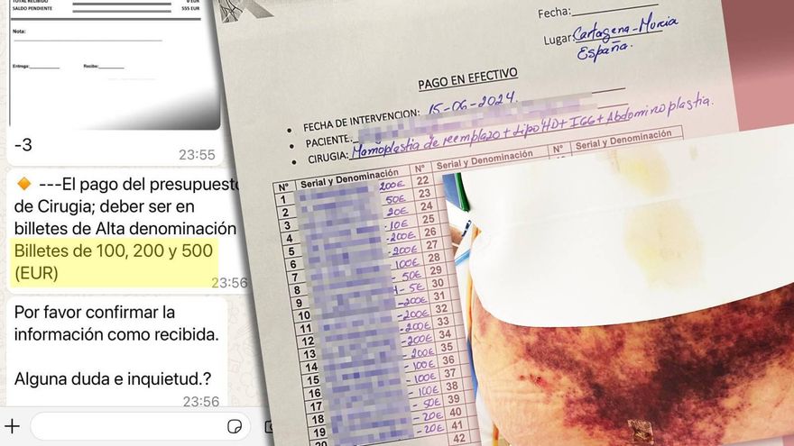Suplantaciones en un hospital murciano, ingresos en la UCI y estafas: qué hay tras la 'reina de la cirugía plástica'
