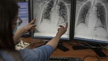 Una trabajadora del área de rayos del hospital muestra unas radiografías de los pulmones de una persona afectada por COVID-19.
