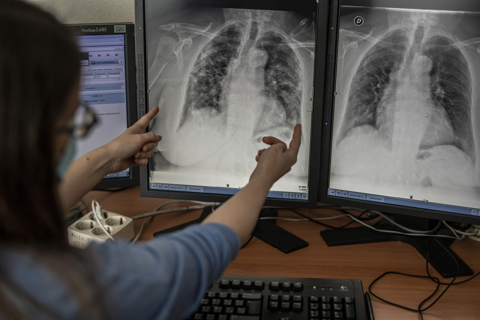 Una trabajadora del área de rayos del hospital muestra unas radiografías de los pulmones de una persona afectada por COVID-19.