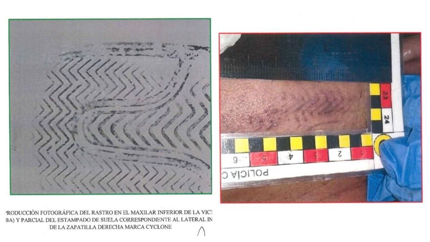 Un zigzag y una curva en la suela prueban que la única huella identificable en la cara de Fernando es la zapatilla de Thomsen