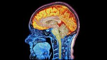 Escáner mejorado digitalmente que muestra el cerebro y la médula espinal
