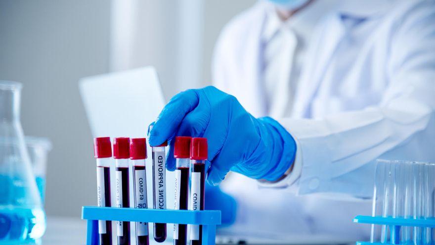 VIH, el conocimiento que empodera pero no acaba con el estigma