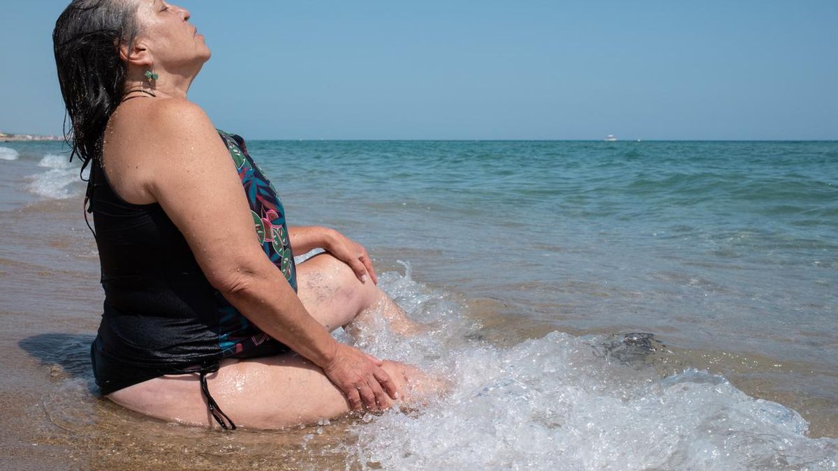 Mujer con varices sentada en la playa