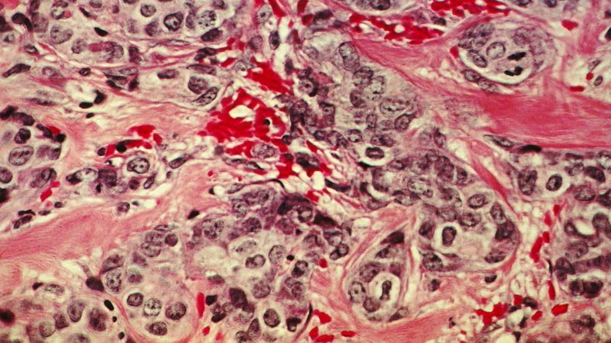 Estudiando la inestabilidad de los genomas para entender el origen del cáncer