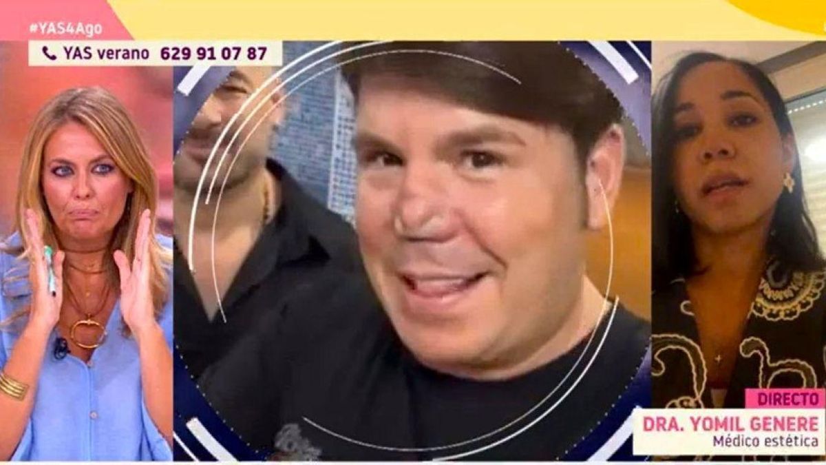 'YAS Verano' habla con una doctora para "poner luz" a la nueva nariz de Lucas: "¿Tiene solución?"