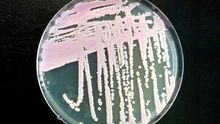 Cepa de Candida auris cultivada en una placa de Petri en un laboratorio del CDC
