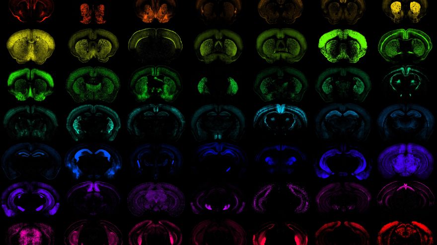 Crean una nueva generación de herramientas biológicas frente a las enfermedades cerebrales