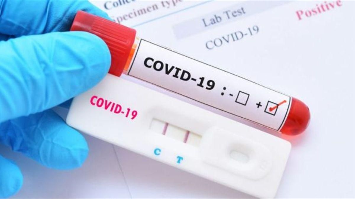Test para detectar anticuerpos de COVID-19.