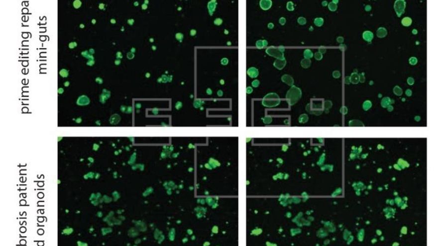 Corrigen mediante edición genética la fibrosis quística en organoides