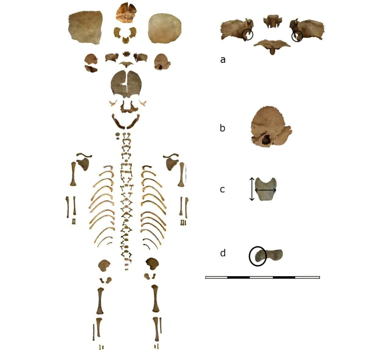 Restos antropológicos del entierro: esqueleto completo (izquierda) y vistas detalladas (derecha)