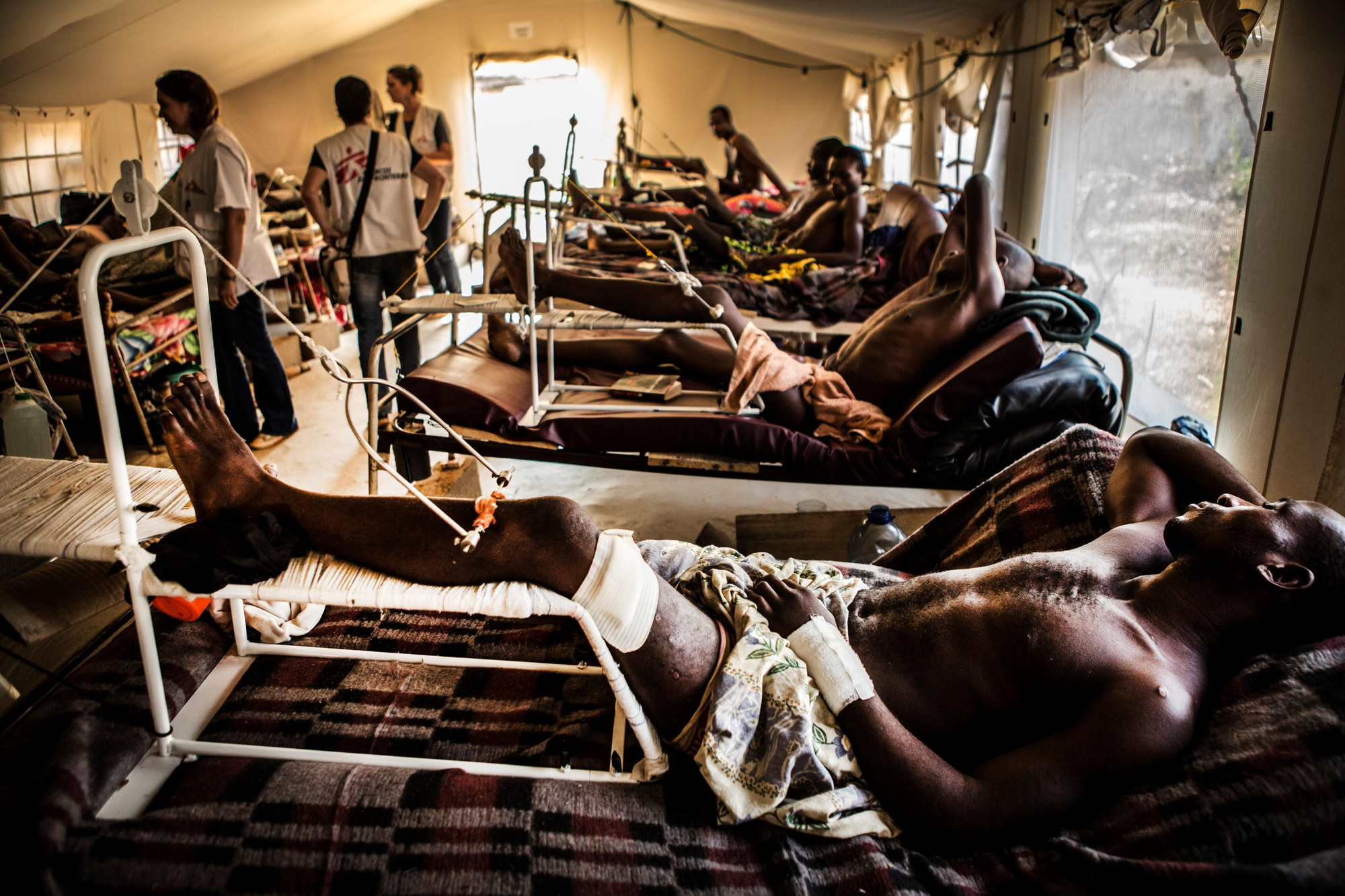 Muchos de los heridos atendidos en el Hospital Comunitario de la capital presentan disparos en las piernas y requieren una hospitalización de 45 días como mínimo. Fotografía: Juan Carlos Tomasi/MSF