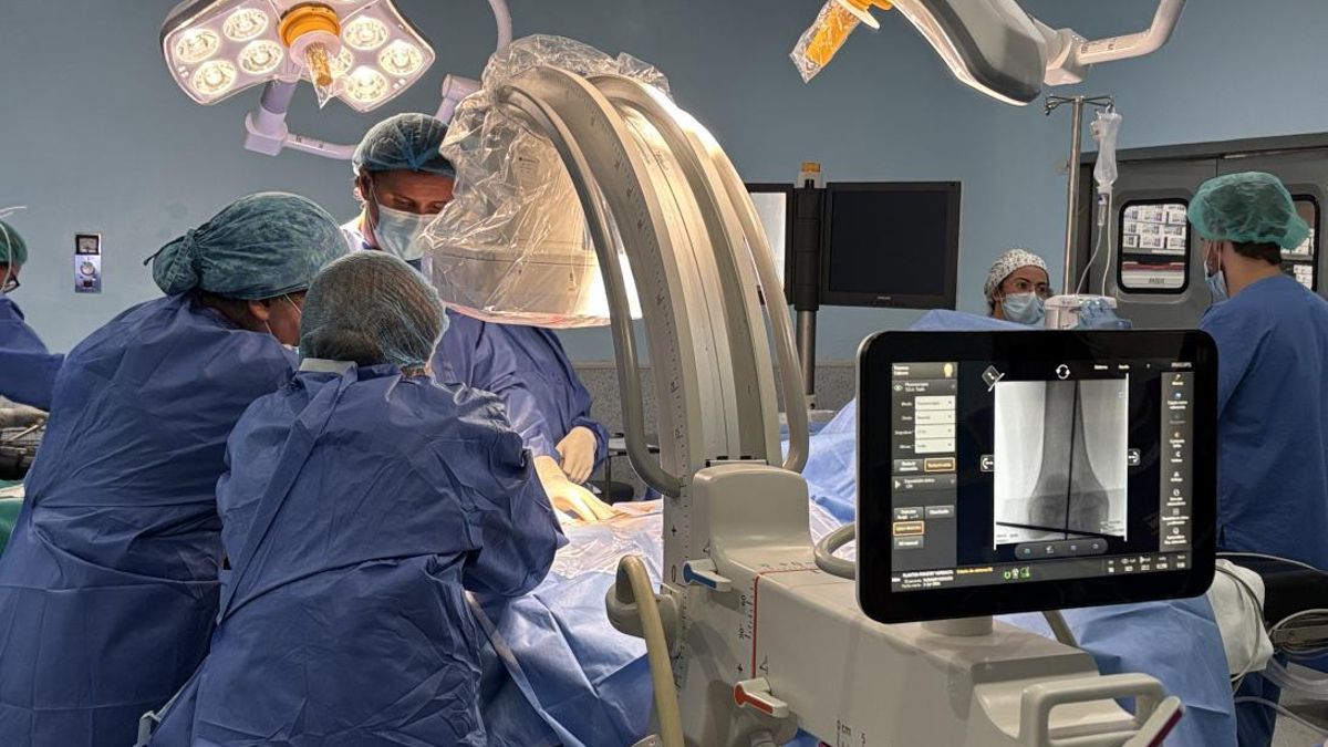 Realizan por primera vez en Castilla-La Mancha una novedosa intervención para el alargamiento óseo