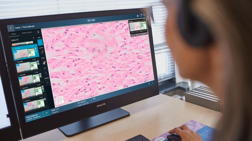 La inteligencia artificial llega al Servicio de Anatomía Patológica de los hospitales de La Rioja