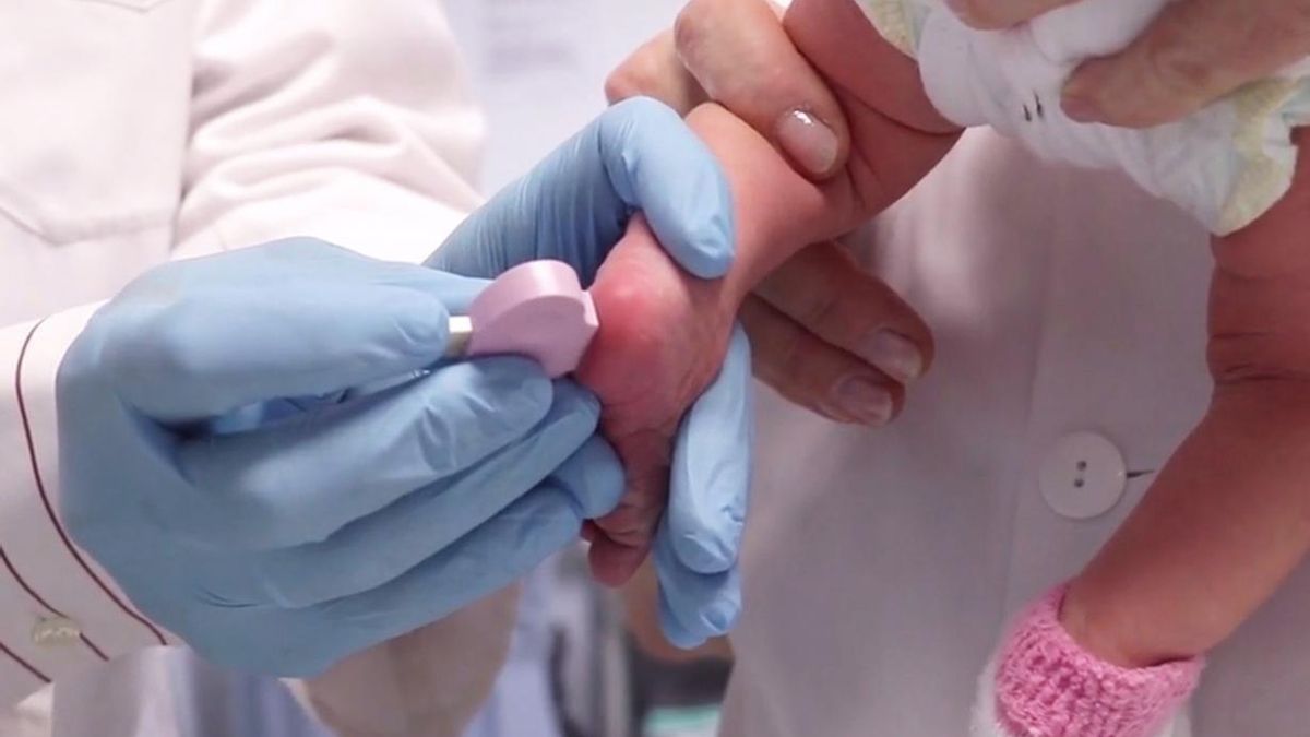 Sanidad amplía los cribados neonatales de la prueba del talón: estas son las nuevas enfermedades