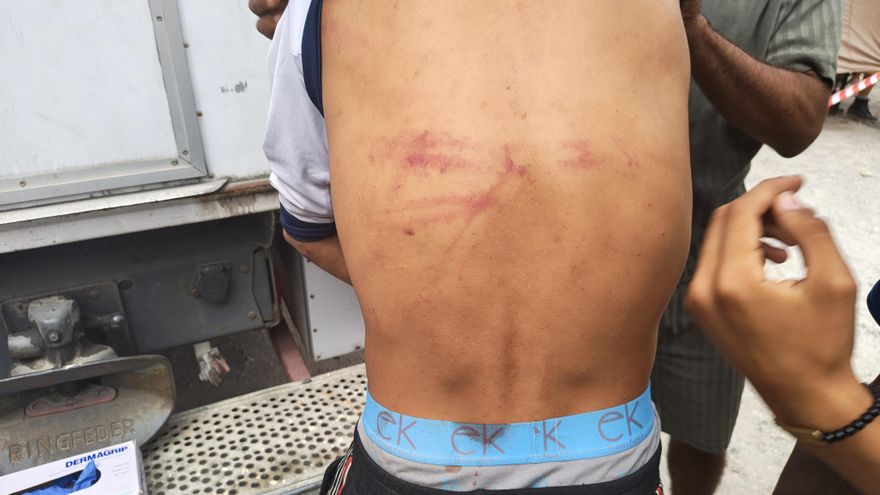 Amnistía Internacional documenta casos de "tortura y tratos degradantes" de militares a migrantes en Ceuta
