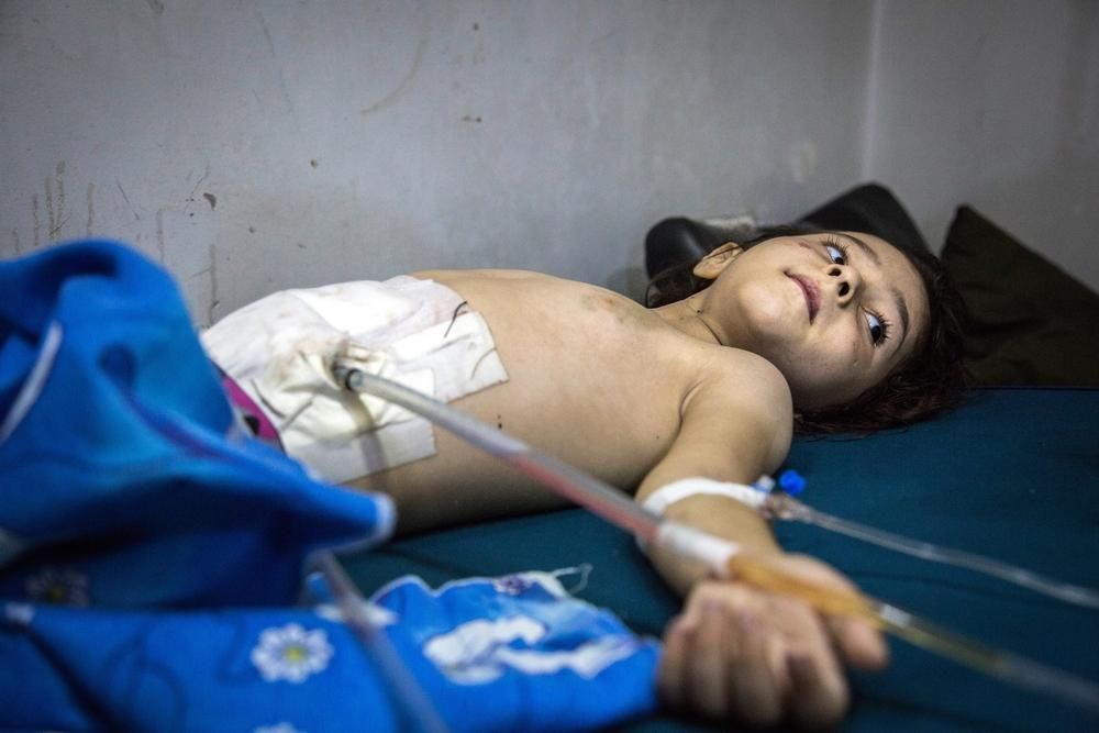 Con solo 5 años, este niño se recupera de una operación de abdomen tras ser alcanzado por la metralla a raíz de varios ataques aéreos en el este de Alepo, en Siria. Desde que comenzó en 2011, el conflicto sirio ha provocado la mayor crisis de desplazamiento desde la Segunda Guerra Mundial. Millones de personas necesitan desesperadamente ayuda humanitaria para sobrevivir. Además, la situación durante los meses del asedio ha sido de una crueldad sin parangón. Incluso los pacientes, los hospitales, el personal médico y las ambulancias han sido objetivo deliberado de los bombardeos por parte de las fuerzas gubernamentales sirias y rusas. © Karam Almasri