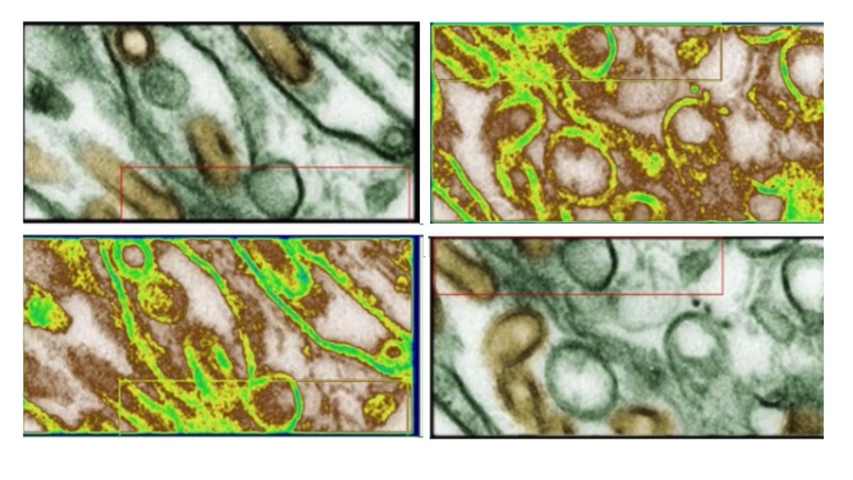 Una imagen científica fraudulenta analizada con la herramienta 'Proofig'