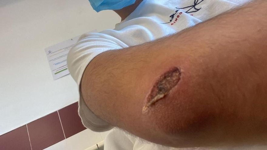 Un joven muestra la herida provocada por una rozadura en la pista del polideportivo Juan de Dios Román.