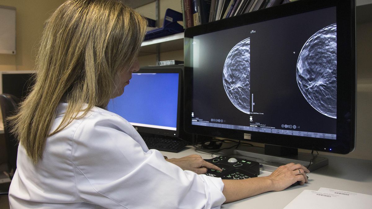 Sanidad amplía los cribados de cáncer de mama a mujeres de entre 45 y 74 años