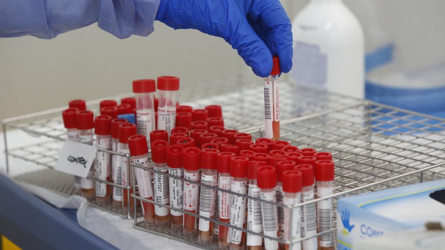 Archivo - Tubos de pruebas PCR para la detección del COVID-19 en el "Autocovid" del Hospital Universitario Central de Asturias (HUCA)