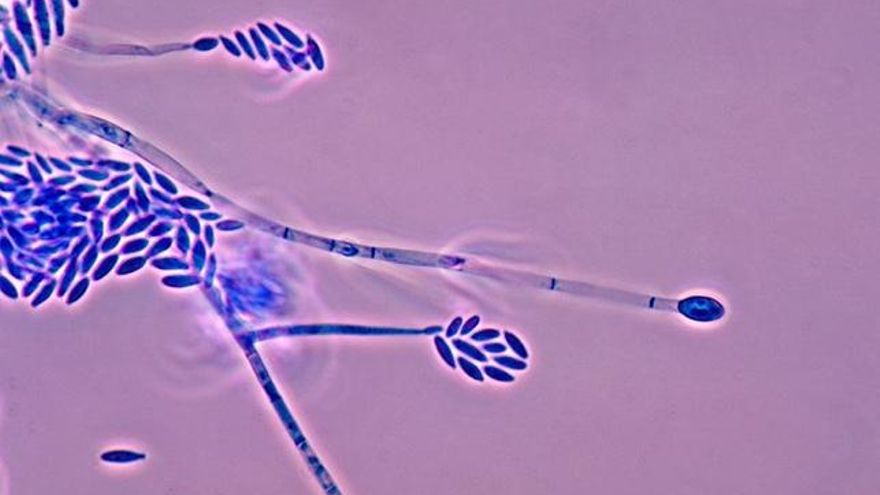 Foto: Public Health Image Library