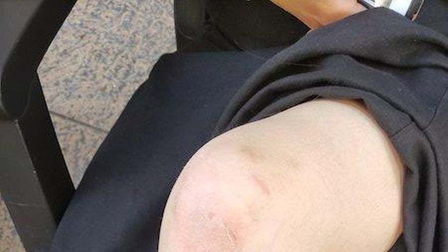 "Cada día hay algún sobresalto en Portales, pasan con bicis y patines a gran velocidad"