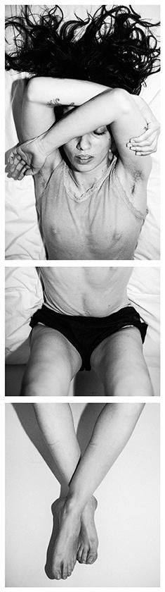 Una de las imágenes expuestas en 'Endometriosis. El dolor silenciado 1860-2026'