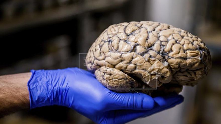 El cerebro humano se actualiza para acostumbrarse a lo inesperado