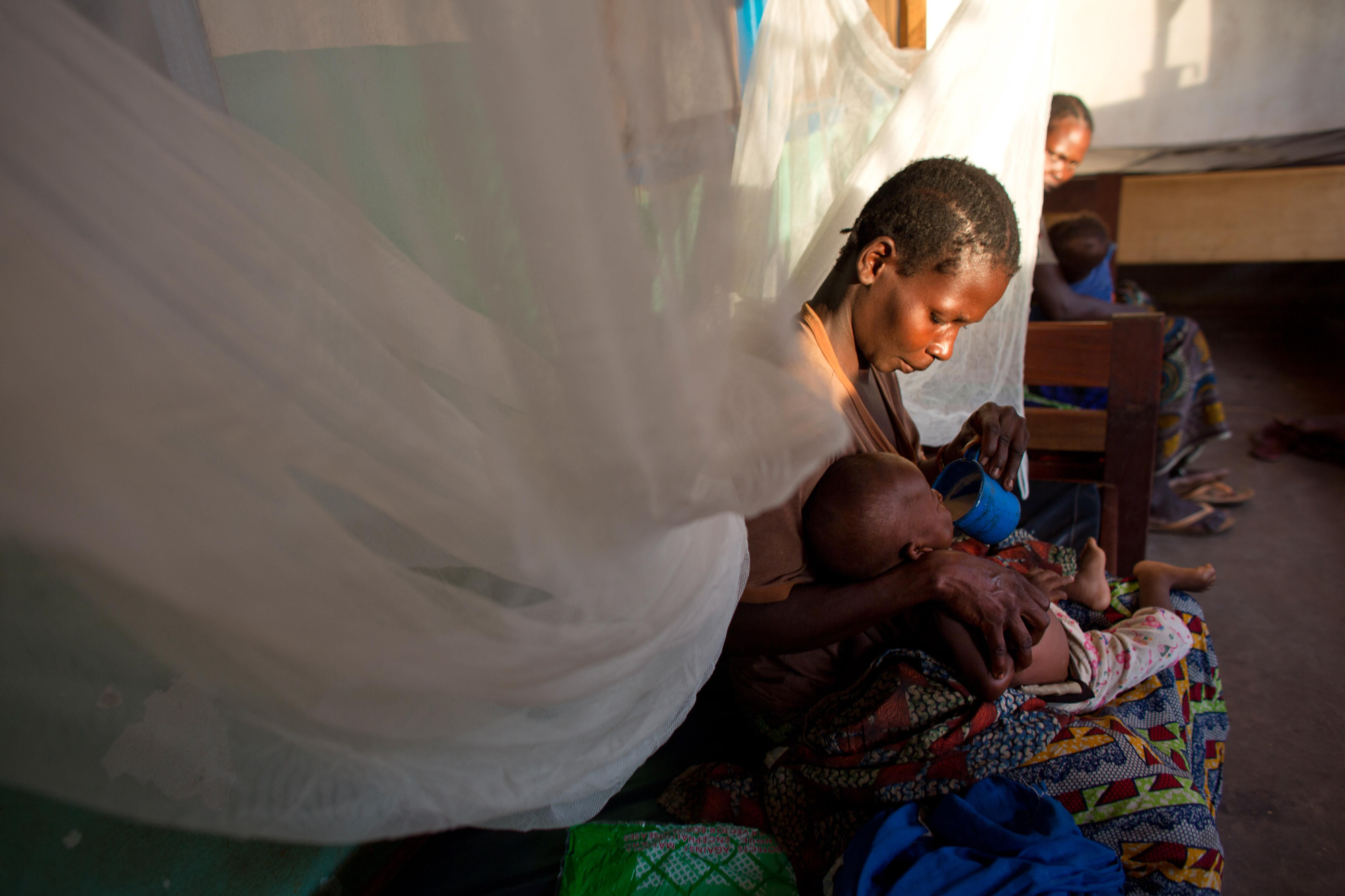 Un niño con malnutrición en el hospital de Batangafo. / Fotografía: Tom Koene