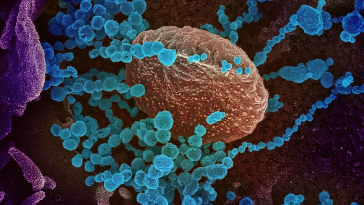 Infección de las proteínas por parte del coronavirus EFE/ NIAID-RML