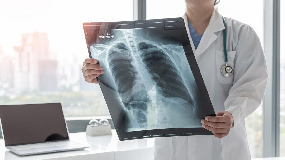 Radiografía pulmonar.