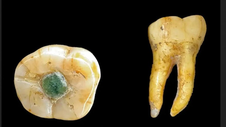 El hallazgo de una muela con una piedra preciosa intriga a los científicos: ¿los mayas ya hacían empastes?