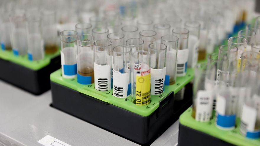 Probetas de pruebas PCR en el Laboratorio de Microbiología del Hospital público Gregorio Marañón, a 31 de mayo de 2022, en Madrid (España).
