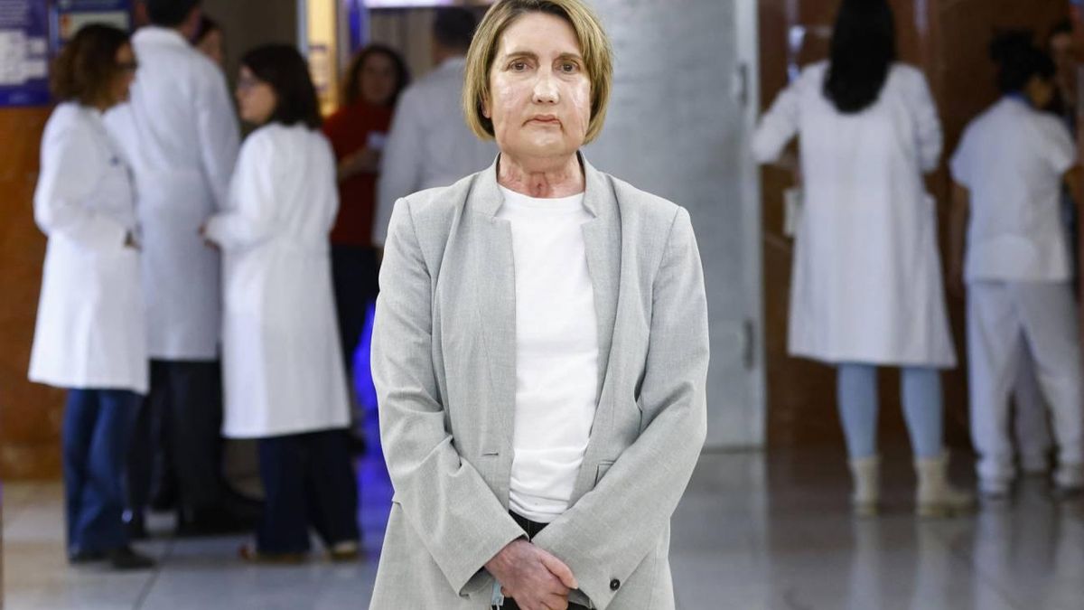 El primer trasplante de cara del mundo con una donante de eutanasia, practicado en España