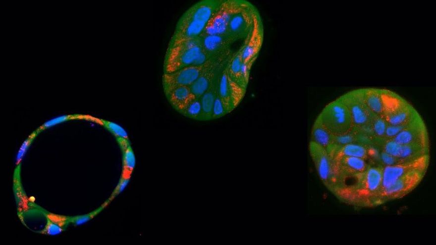 Editan y corrigen por primera vez el inaccesible ADN de las mitocondrias, que produce graves enfermedades raras