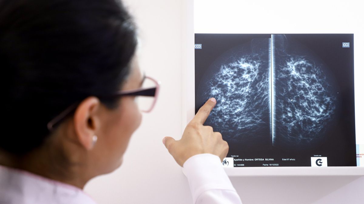 El Gobierno de Cantabria externaliza parte de las pruebas del cribado de cáncer de mama ante los retrasos acumulados