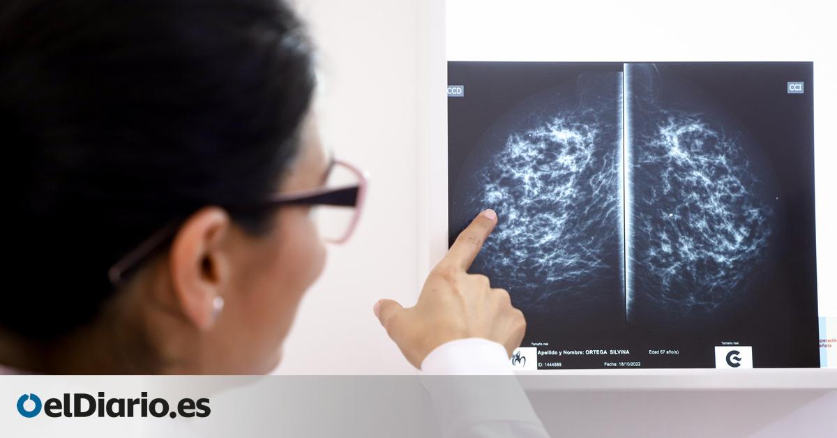 El Gobierno de Cantabria externaliza parte de las pruebas del cribado de cáncer de mama ante los retrasos acumulados