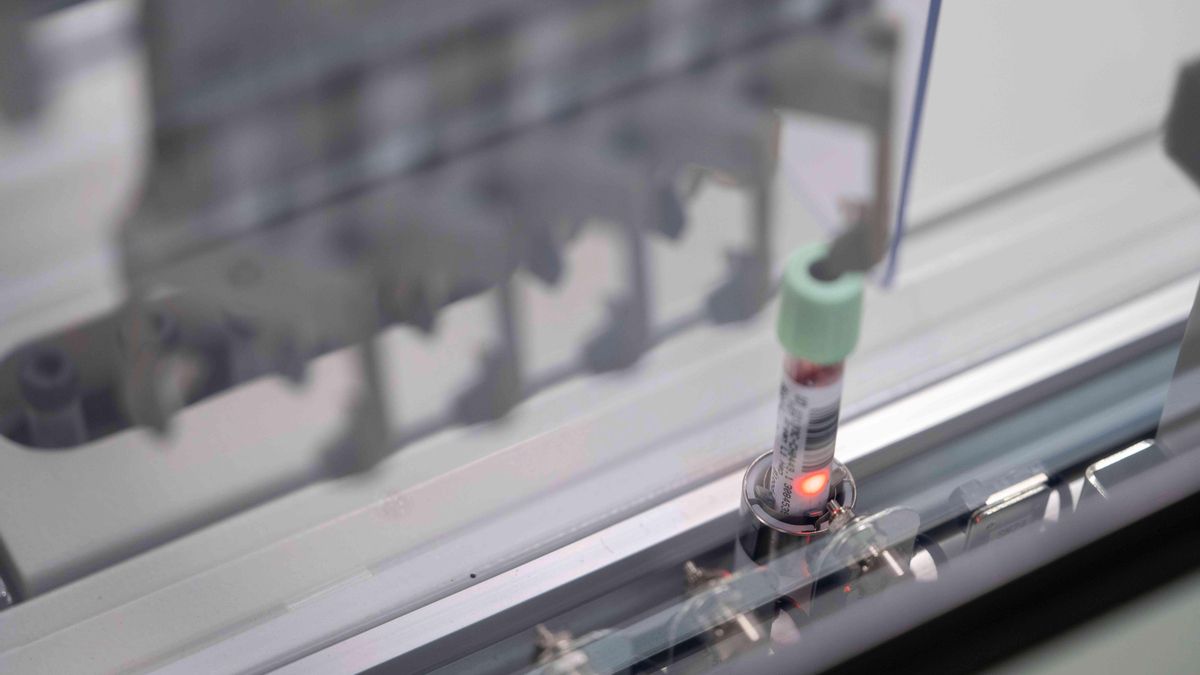 Un test experimental de sangre abre la puerta a detectar el cáncer de páncreas cuando es más fácil de tratar