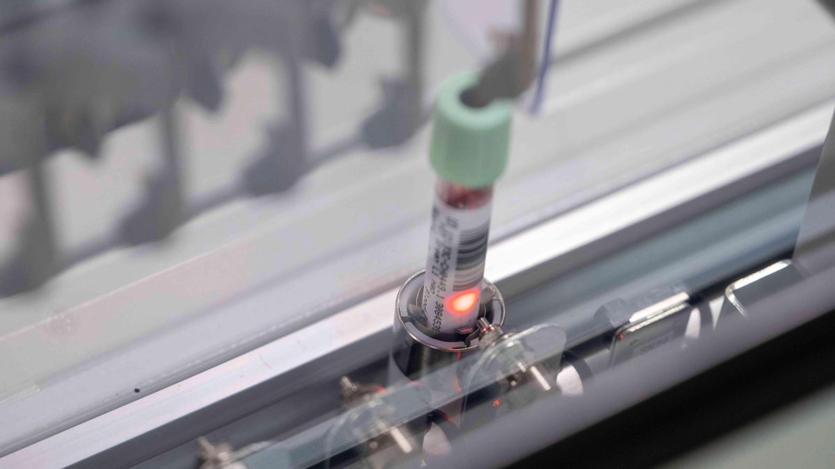 Un test experimental de sangre abre la puerta a detectar el cáncer de páncreas cuando es más fácil de tratar